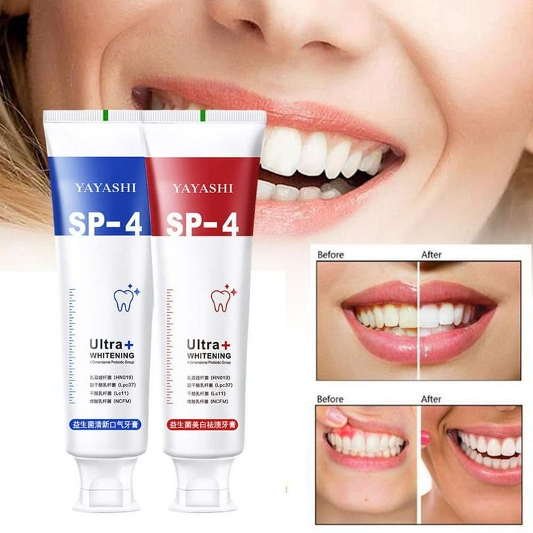 SP-4 Probiotics Whitening Toothpaste