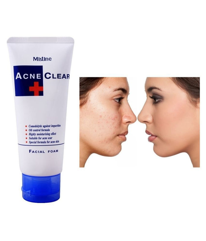 Acne Control Face Wash